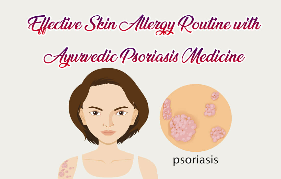 Effective Skin Allergy Routine with Ayurvedic Psoriasis Medicine
